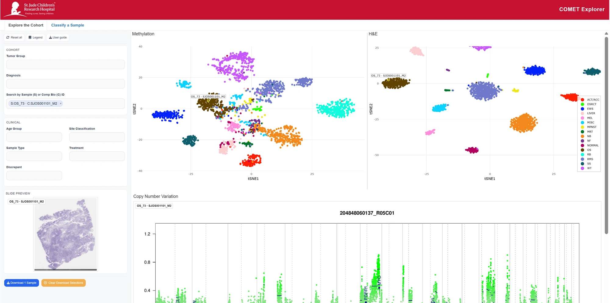 COMET Explorer with cohort filters, linked methylation and histology plots, a slide preview and copy-number data