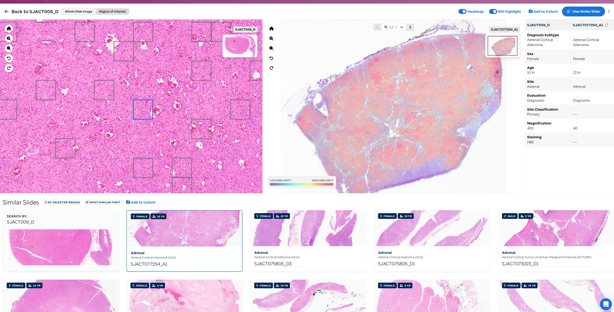 PeCan Histology comparing a selected tissue region with similar slides and a similarity heatmap